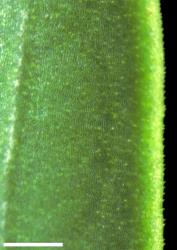 Veronica traversii. Minute hairs on leaf margin. Scale = 1 mm.
 Image: W.M. Malcolm © Te Papa CC-BY-NC 3.0 NZ